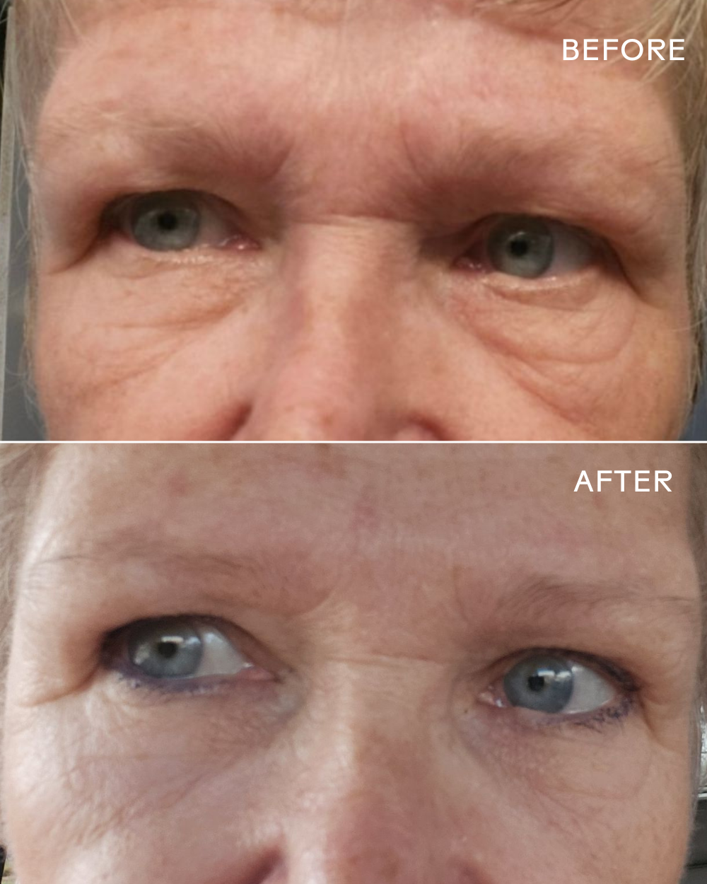 Three Ships Eye Hero Bio-Retinol Smoothing Eye Cream