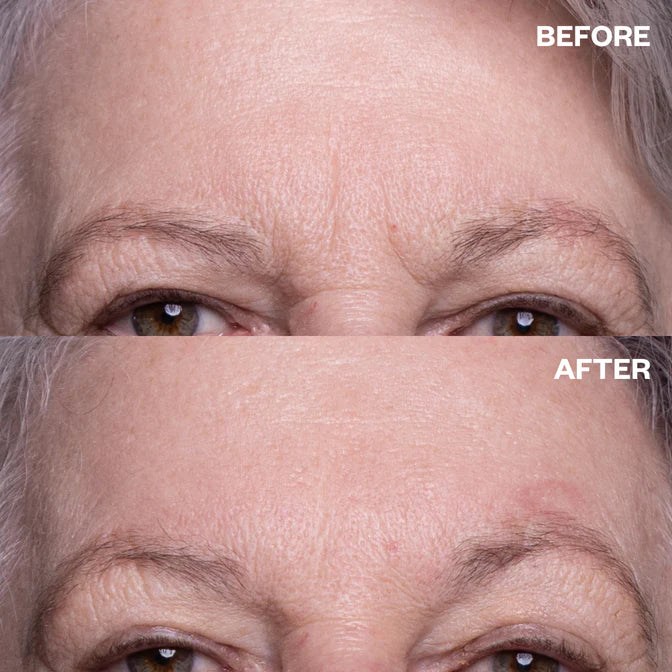 Wrinkles Schminkles Forehead Wrinkle Patch
