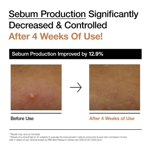 Before and after comparison of sebum production improvement on skin with text indicating a 12.9% improvement after 4 weeks of use.