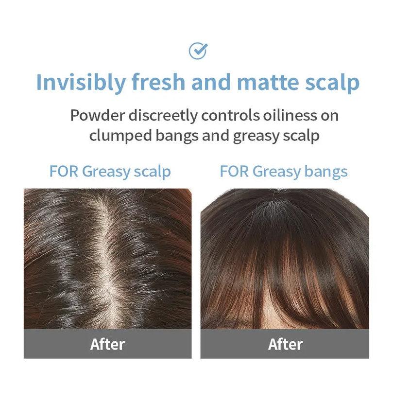 Product advertisement for scalp care with before and after images on a white background.