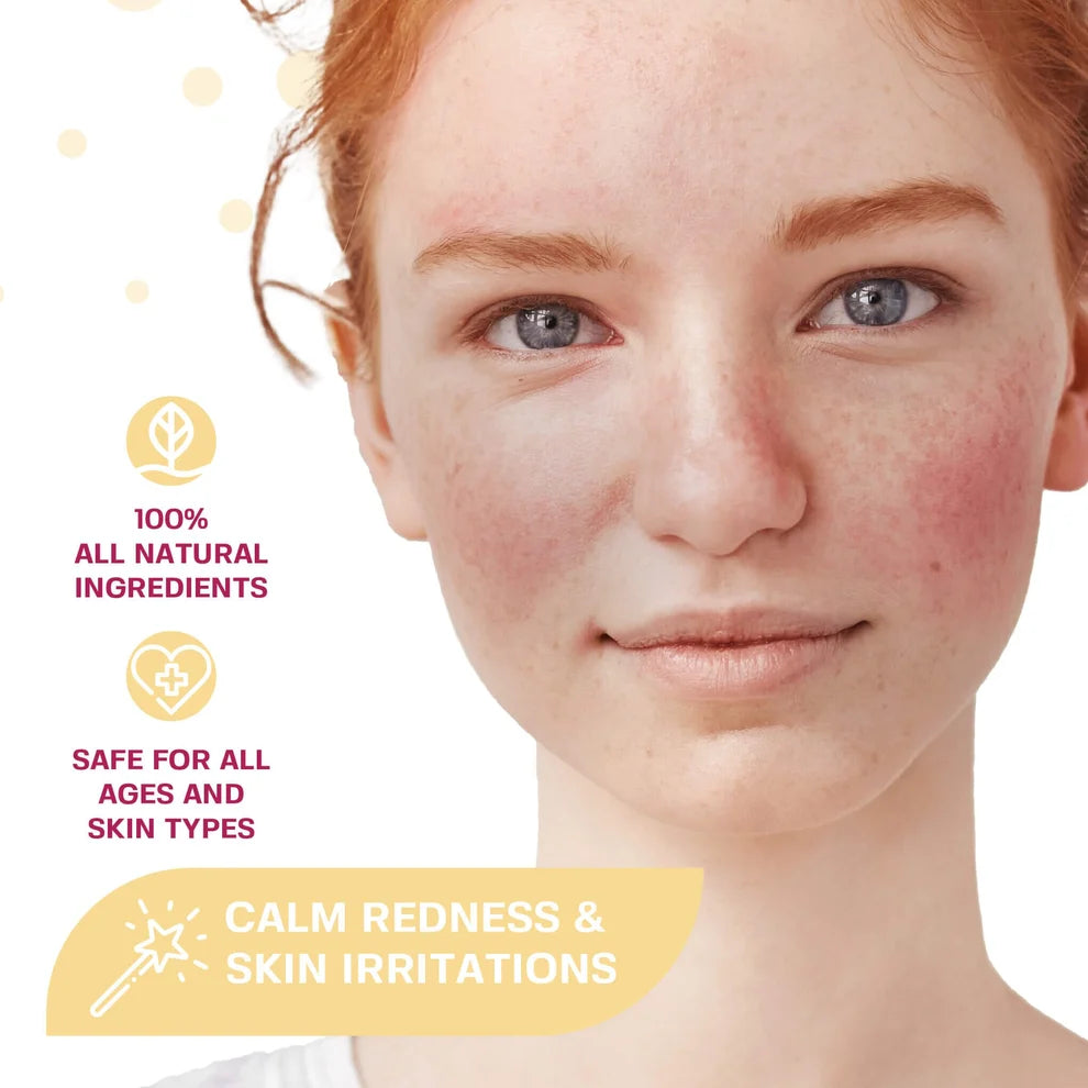 Close-up of a young woman with red, irritated skin and freckles, with marketing text on the left reading '100% All Natural Ingredients', 'Safe for All Ages and Skin Types', and 'Calm Redness & Skin Irritations'.