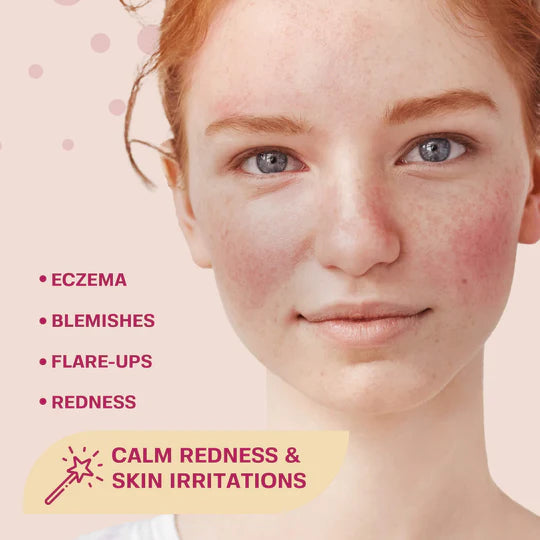 Woman with redness on her face, showing symptoms of eczema, blemishes, flare-ups, and redness, with a product feature for calming redness and skin irritations.