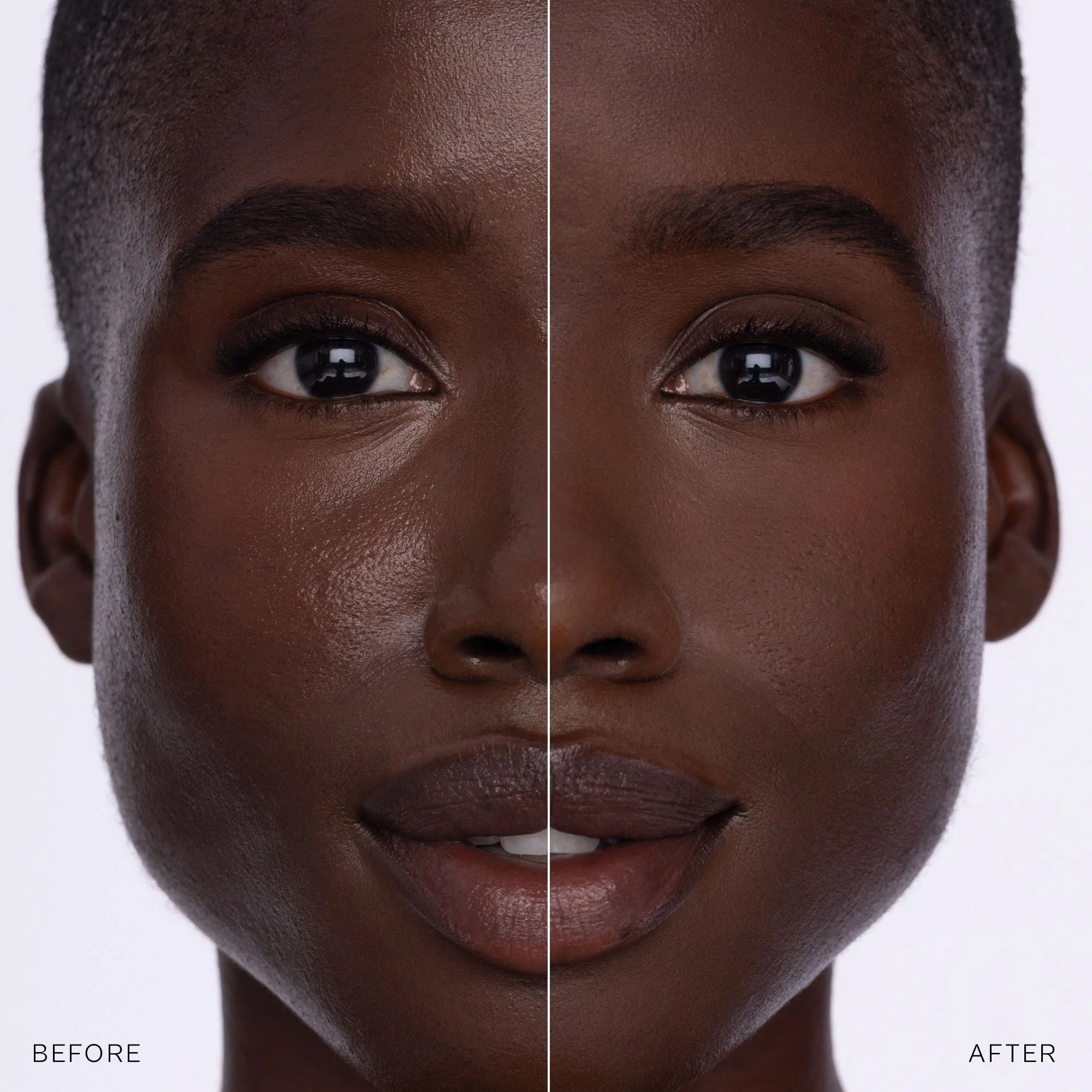 Before and after comparison of a woman's face with a visible skin treatment effect.