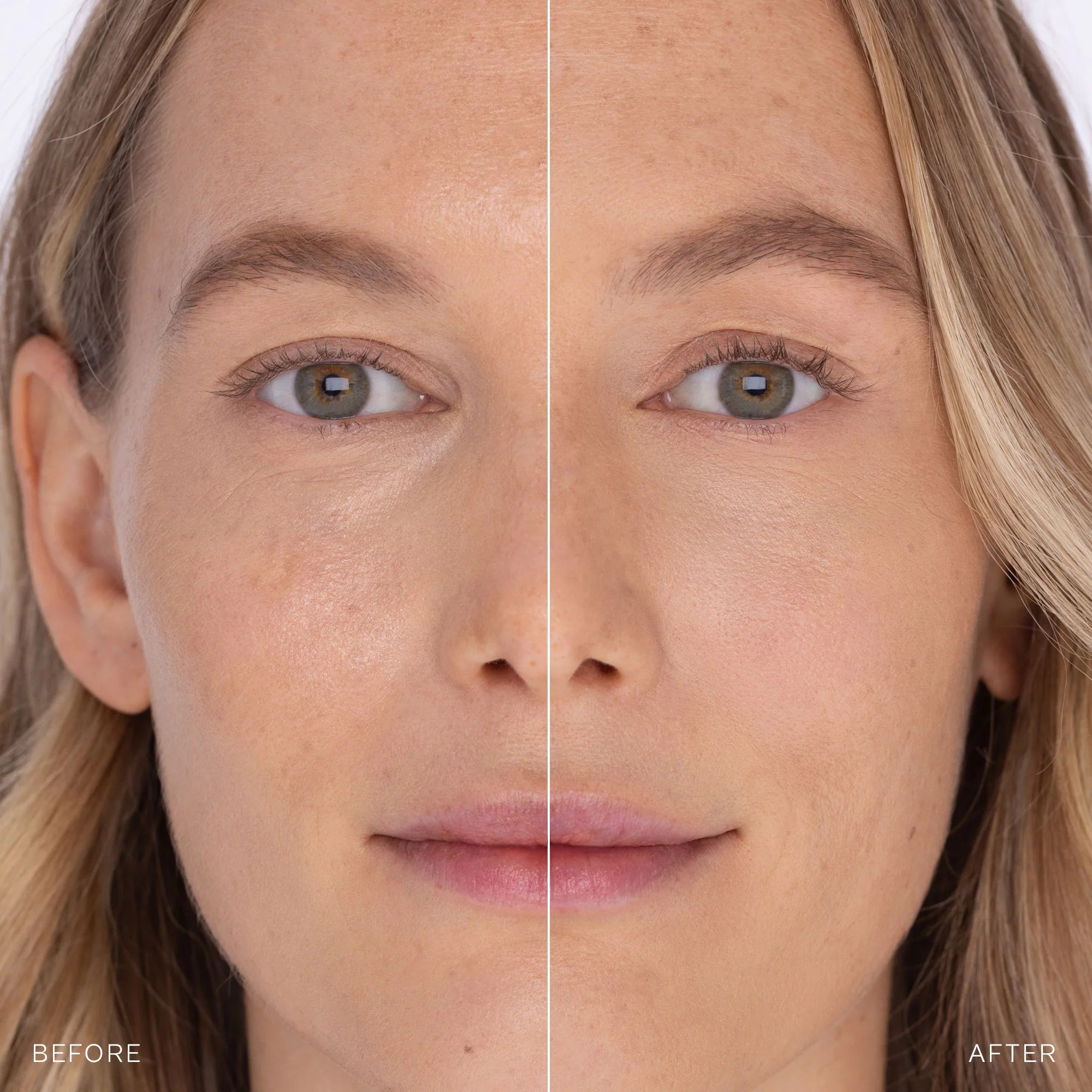 Before and after comparison of a woman's face with visible skin texture differences.