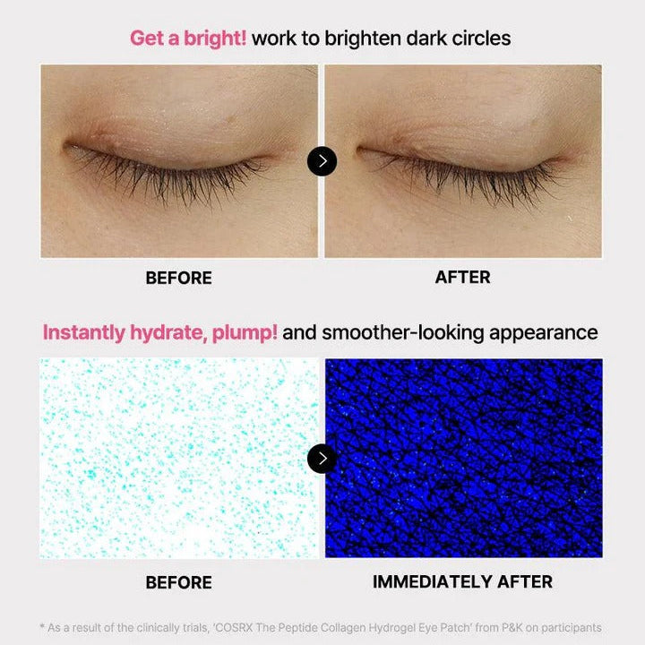 Before and after comparison showing brighter under-eyes and improved hydration after using Peptide Collagen Eye Patches – The Pharmacy Lab.