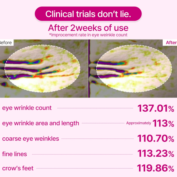 Before and after comparison of eye wrinkles with clinical trial statistics on a pink background.