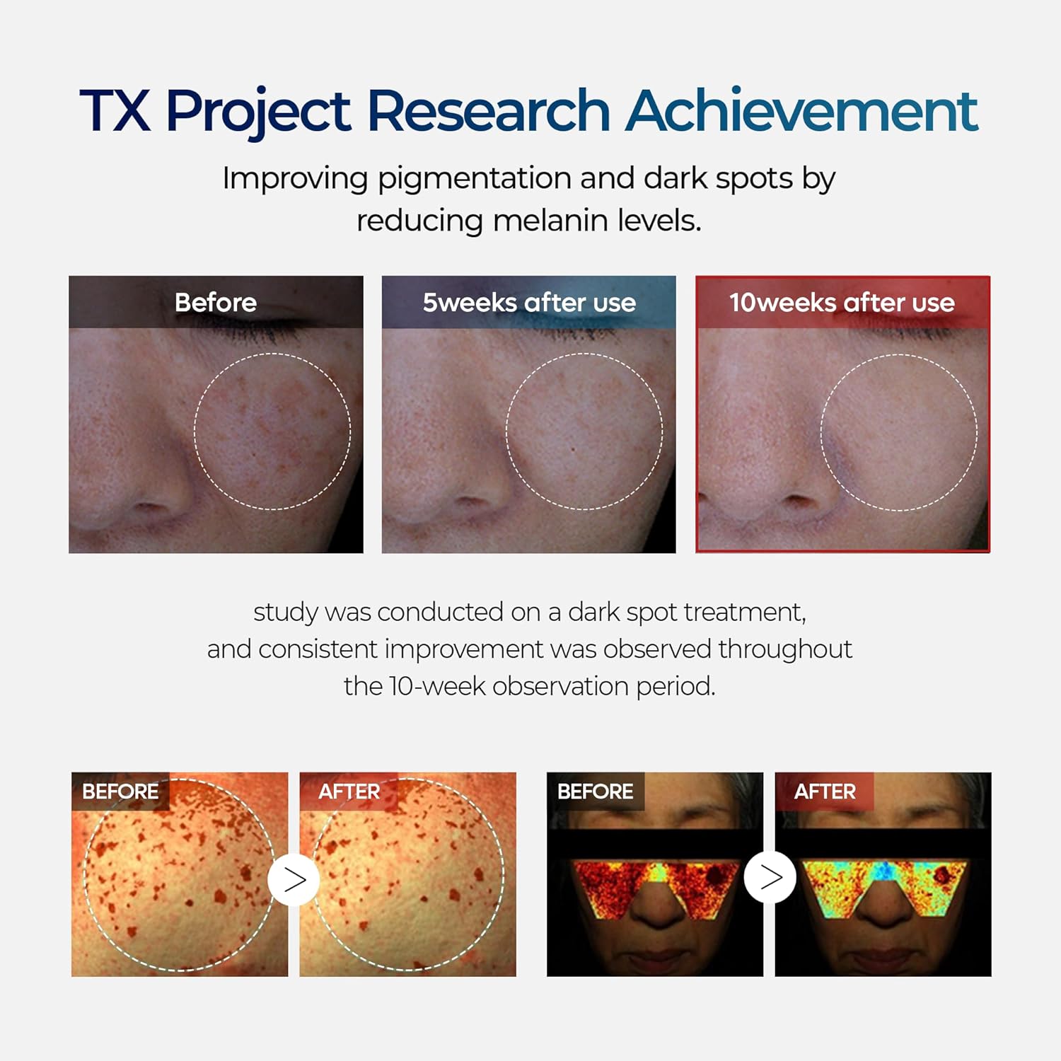Before and after effects of a dark spot treatment on skin, with text about TX Project Research Achievement.