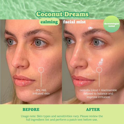 Before and after skin results with ESW Beauty Coconut Dreams Calming Infused Water Facial Mist from The Pharmacy Lab for calming dry, red, irritated skin.