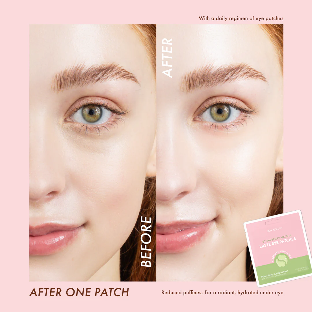 The Pharmacy Lab before and after results showing reduced under-eye puffiness using ESW Beauty Strawberry Matcha Latte Eye Patches