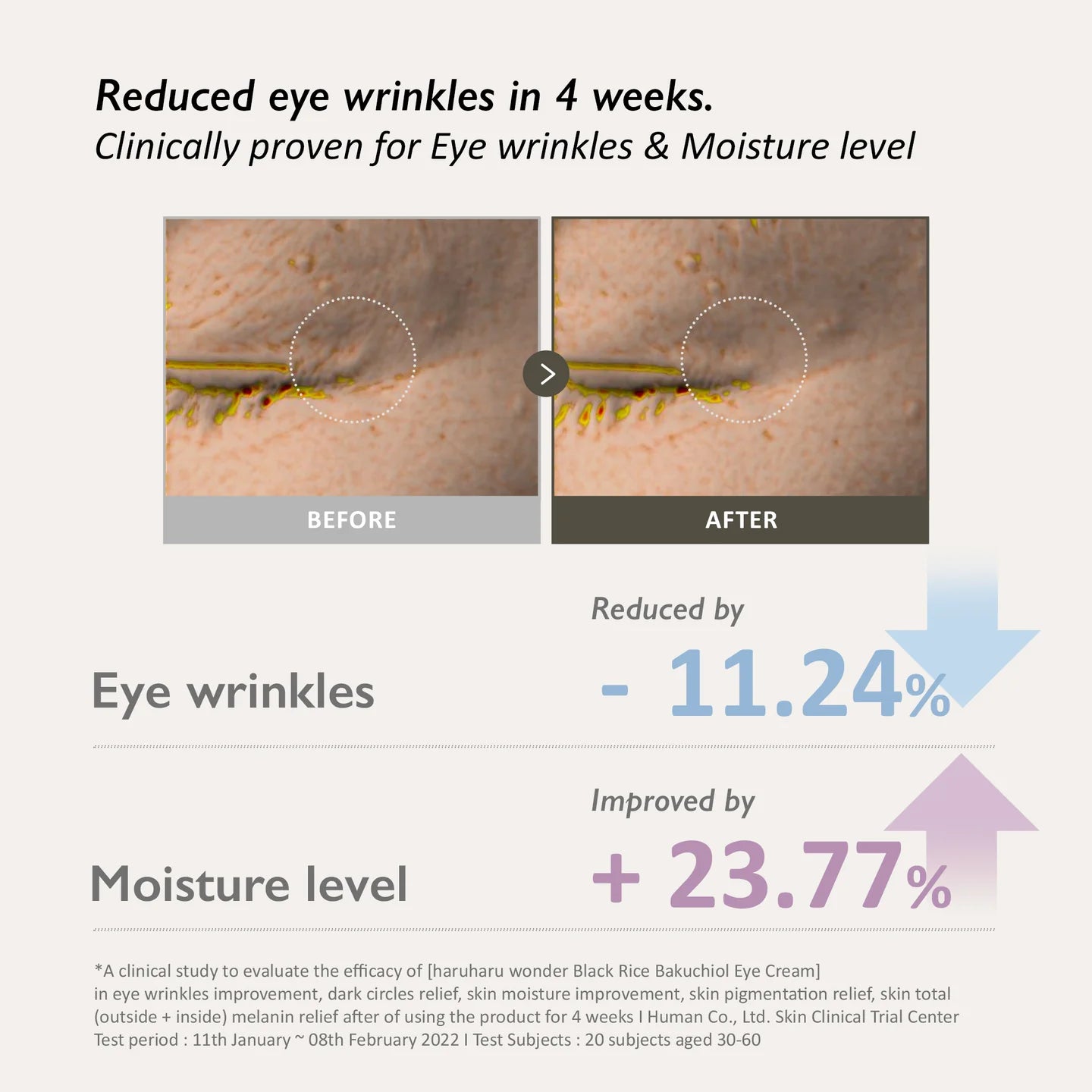 Before and after comparison of eye wrinkles with clinical data on a white background