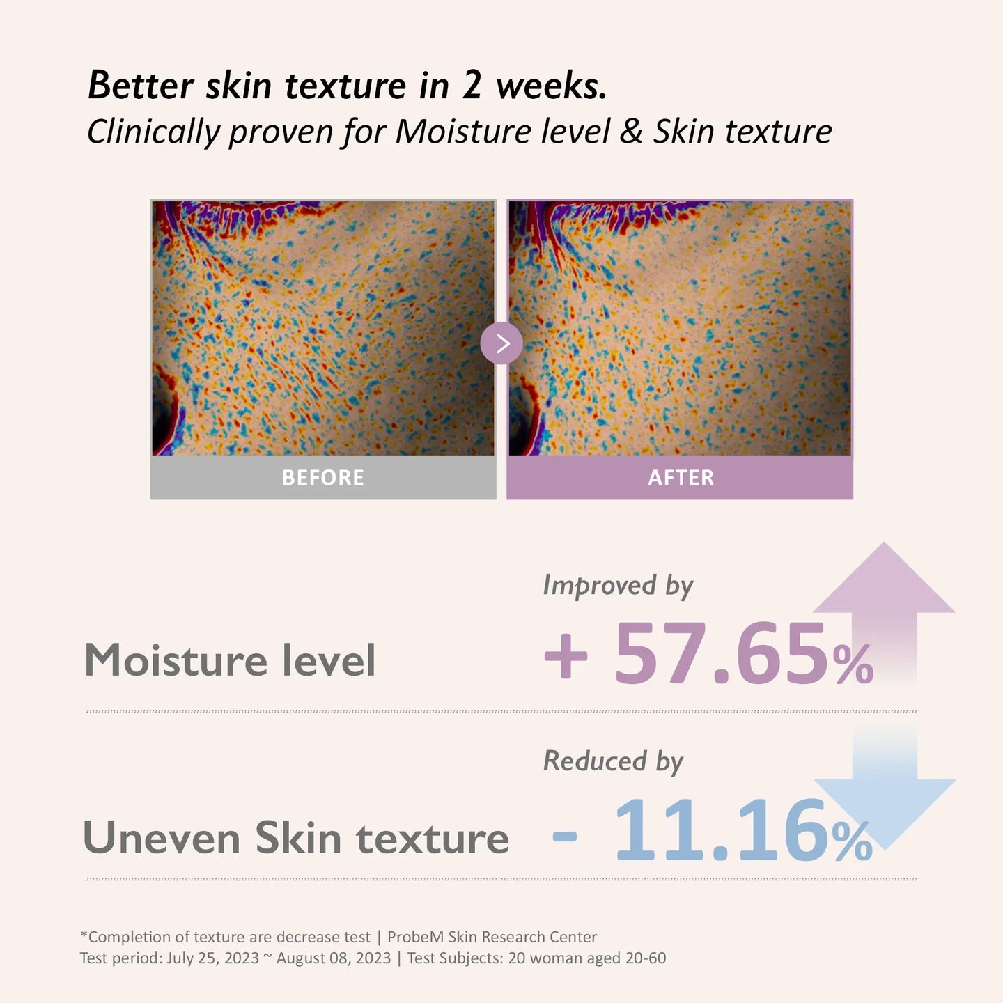 Before and after comparison of skin texture with statistical improvement details on a beige background.
