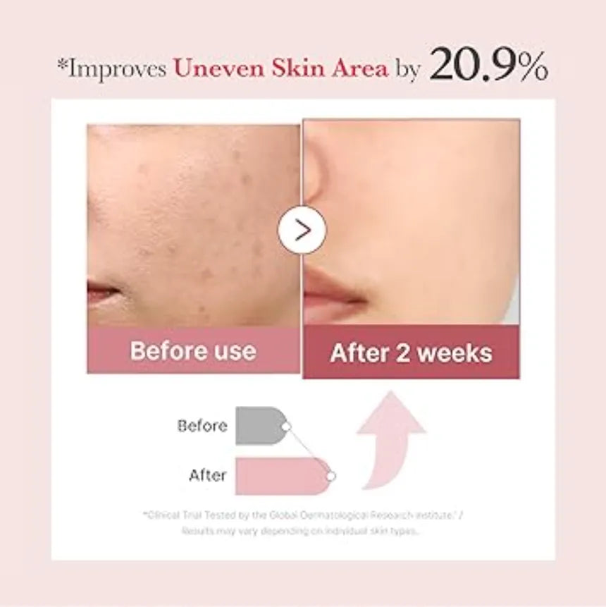 Before and after comparison of skin improvement with text indicating 20.9% improvement.