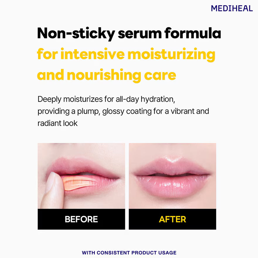 Advertisement for Mediheal lip serum showing before and after effects on lips.
