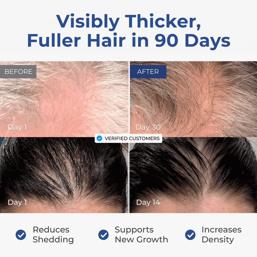 Before and after comparison of hair thickness and density with text indicating results in 90 days.