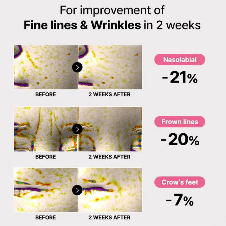 Clinical improvement of fine lines and wrinkles in two weeks after using Peptide Collagen Eye Patches – The Pharmacy Lab.
