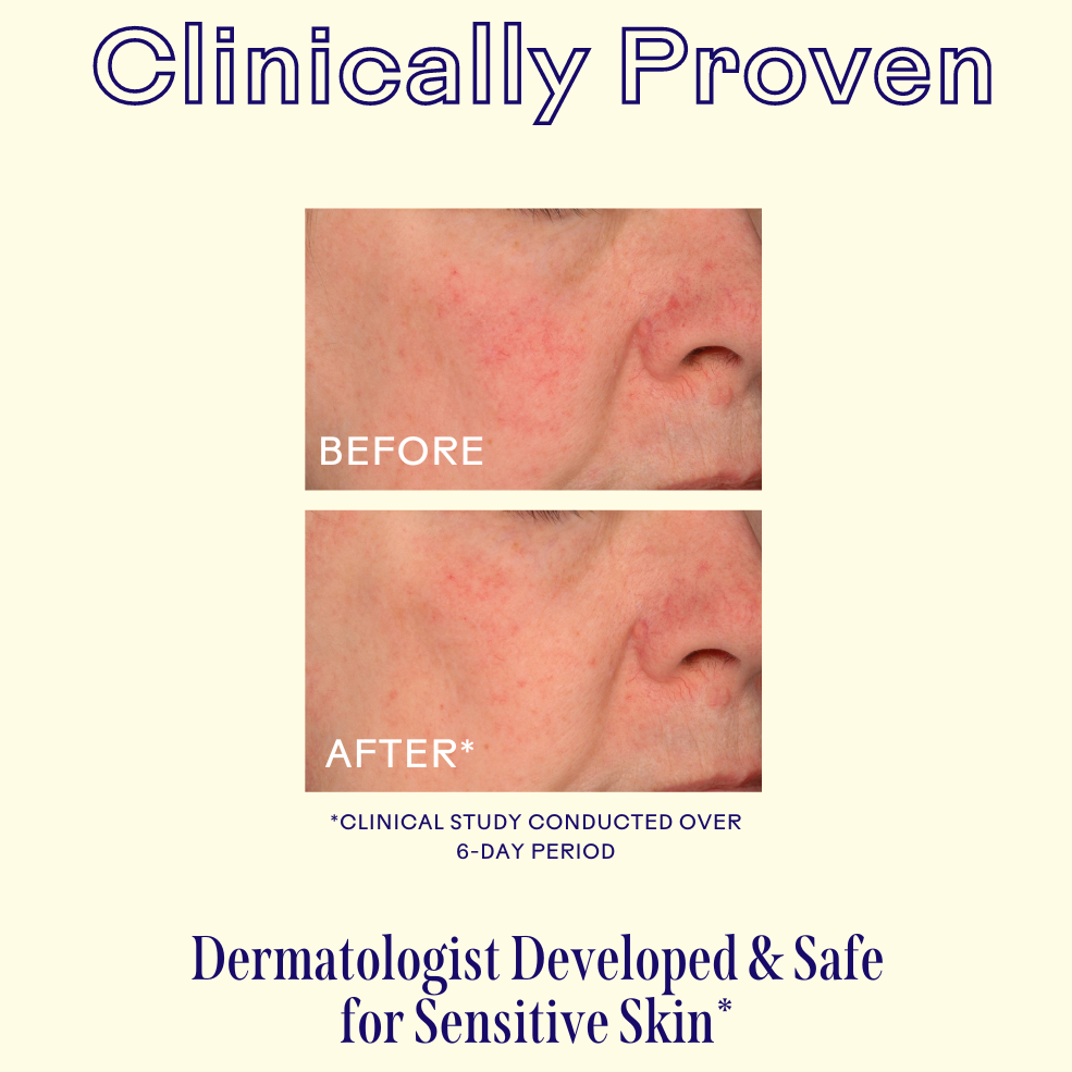 Before and after skin treatment showing redness reduction on a person's face, with text indicating clinical provenance and dermatologist safety.