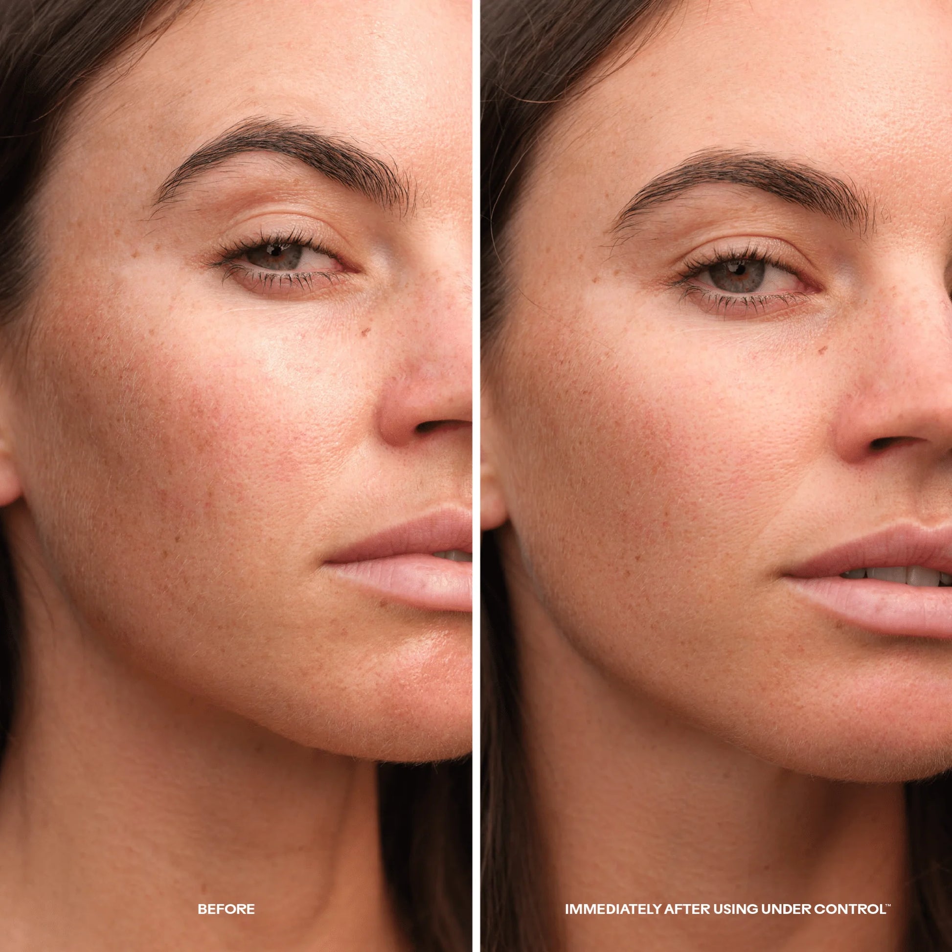 Before-and-after close-up comparison of a woman's face showing skin texture and blemish reduction, with text reading 'BEFORE' and 'IMMEDIATELY AFTER USING UNDER CONTROL'.